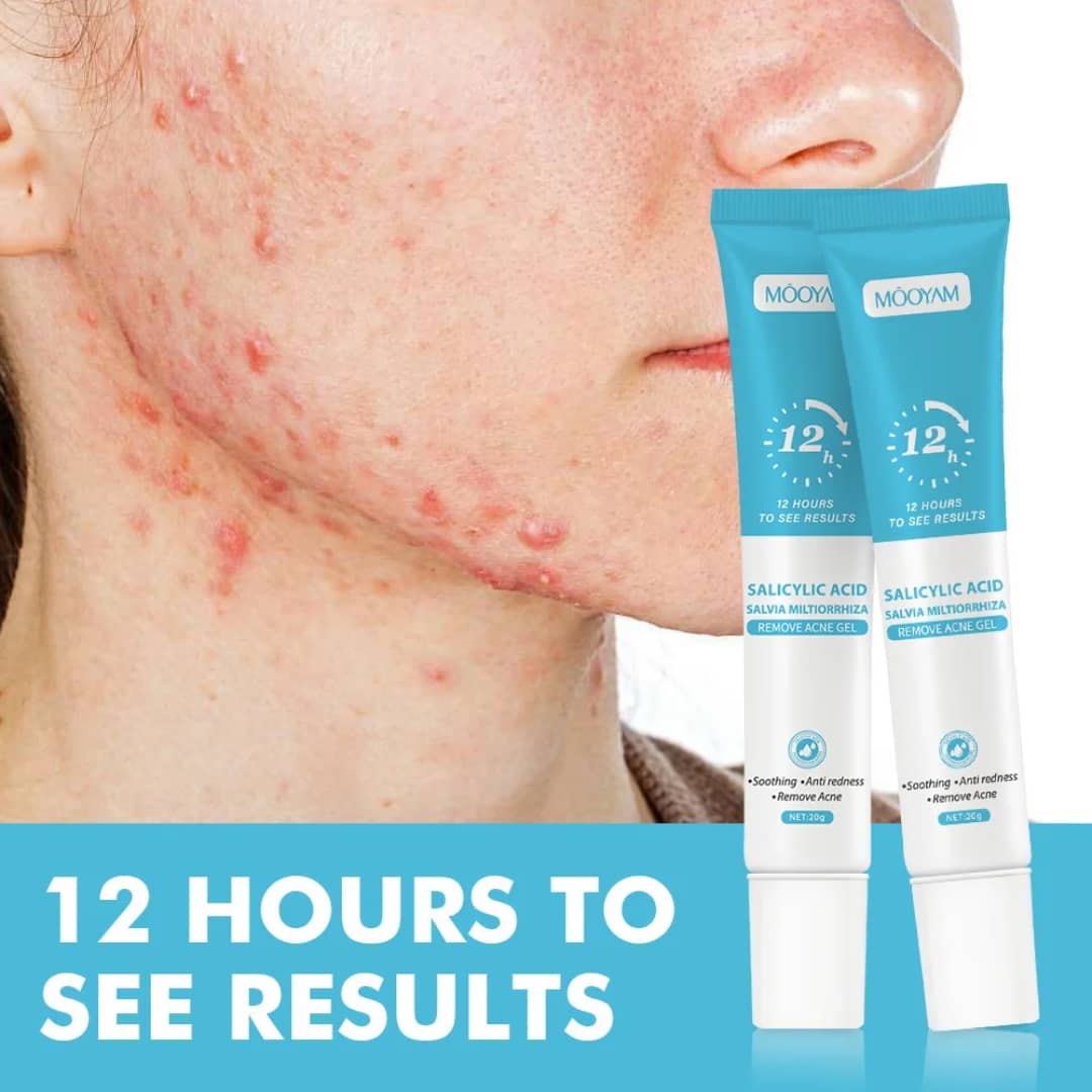 Gel anti-acné - vue 5 - Sylite Boutique