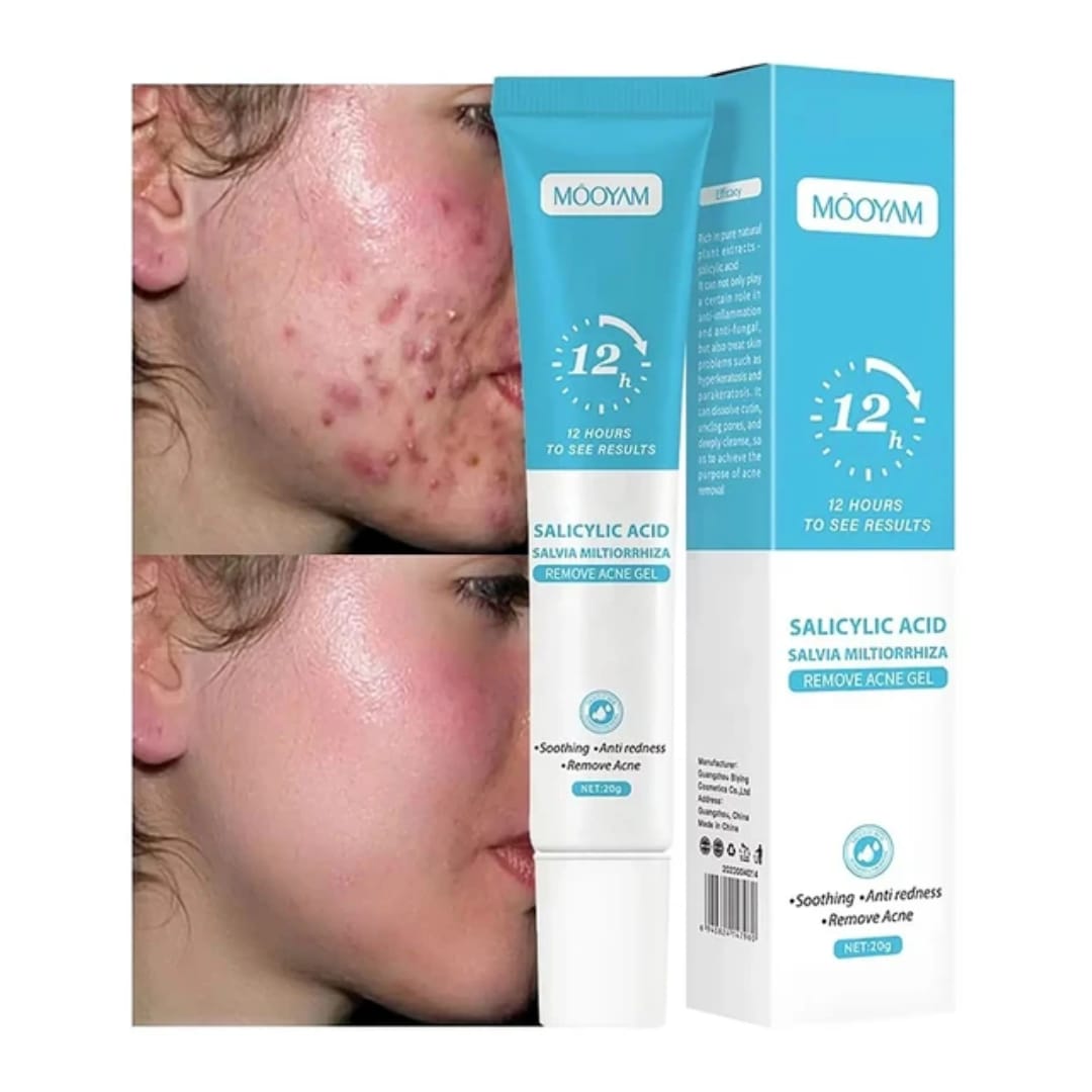 Gel anti-acné - vue 6 - Sylite Boutique